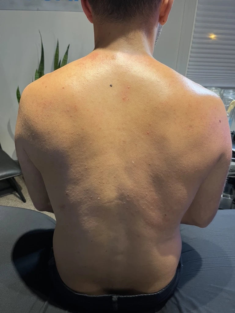 Men's Back After Back Facial